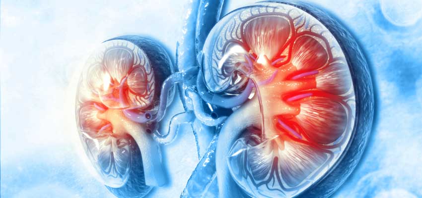 Chronic Kidney Disease