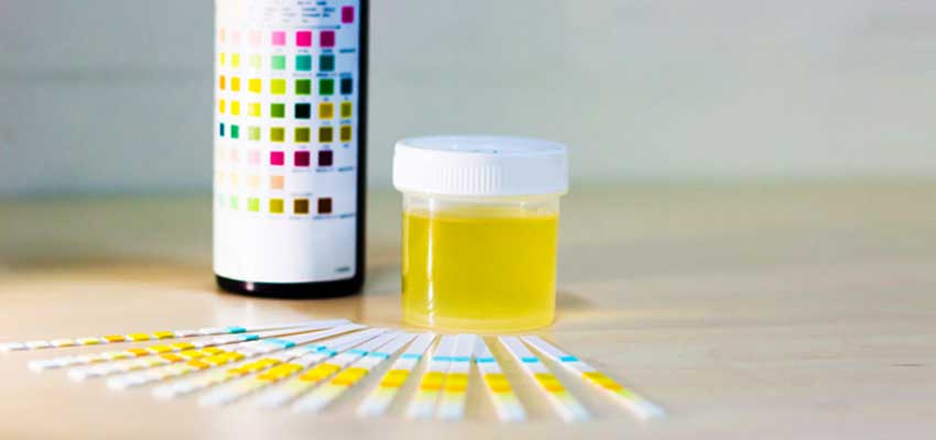 Proteinuria Treatment