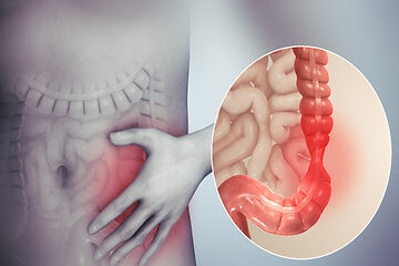 IBS Treatment